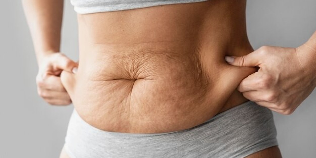 Beverly Hills Med Spa: Premier Fat Cavitation Near Me