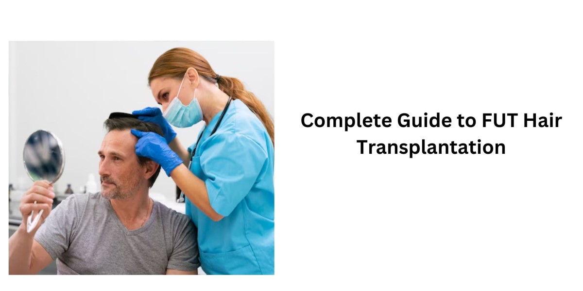 Complete Guide to FUT Hair Transplantation