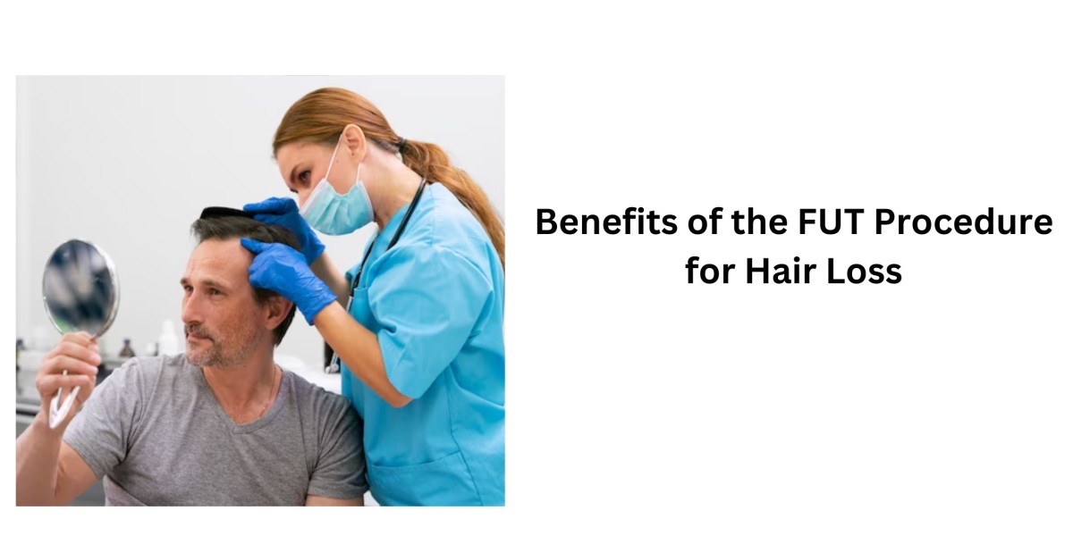 Benefits of the FUT Procedure for Hair Loss